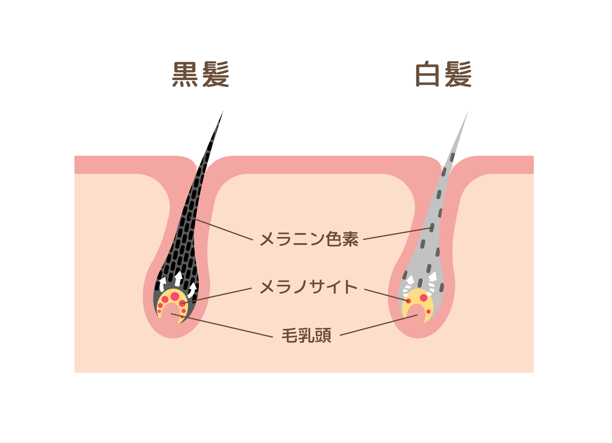 白髪が増える主な原因